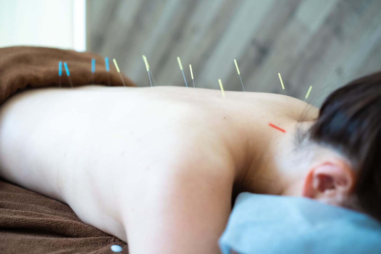 電気鍼イメージ